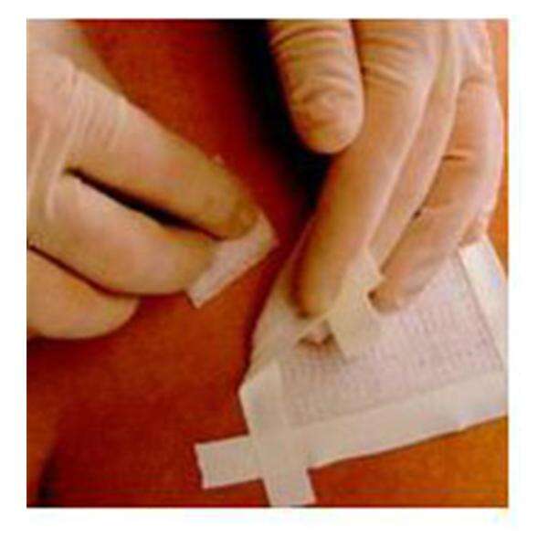 Wipe Accessory Remove 50/Bx, 20 BX/CA